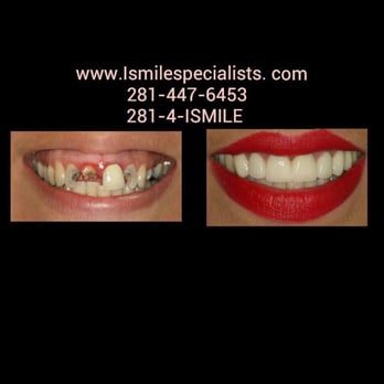 iSmile Specialists - Orthodontists Near Me - Sugar Land, Texas iSmile Specialists - Orthodontists Near Me - Sugar Land, Texas