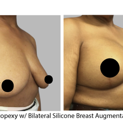 Lexington Plastic Surgeons