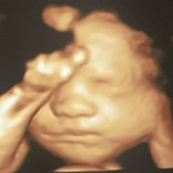 Blessings 3D 4D Ultrasound