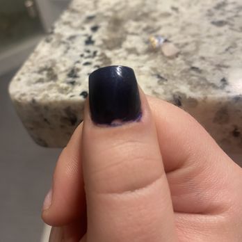 Venice Nail Studio - Lifting and all of the nail polish in around the edges. - Nail Salons Near Me - Citrus Heights, California Venice Nail Studio - Lifting and all of the nail polish in around the edges. - Nail Salons Near Me - Citrus Heights, California