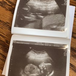 The Bump Studio - Ultrasound