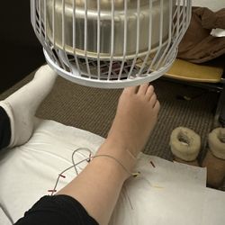 Acuhope Acupuncture - Acupuncture Chinese medicine and heat therapy for blood flow.