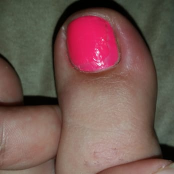 World Nails & Spa - Awful paint job and infection from improper sterilization! - Nail Salons Near Me - Royse City, Texas World Nails & Spa - Awful paint job and infection from improper sterilization! - Nail Salons Near Me - Royse City, Texas