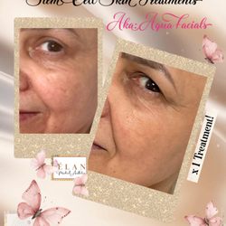 ELAN Medical Aesthetics