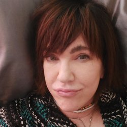 Thomas D Toohey, MD - This is my facelift at 3 weeks healed