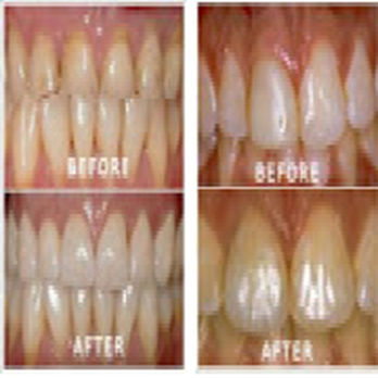 William J Geyer, DDS - Cosmetic Dentists Near Me - Lutz, Florida William J Geyer, DDS - Cosmetic Dentists Near Me - Lutz, Florida