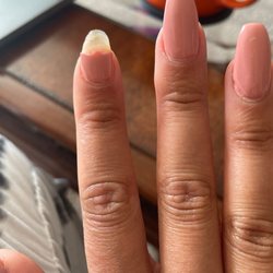 Pro Top Nails - Broken nail within 2 days
