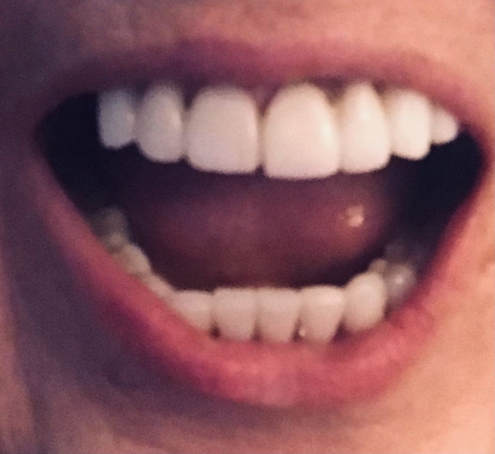 CENTER FOR DENTAL EXCELLENCE Updated October 2024 625 Hopmeadow St