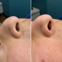 Bare Beauty By Myranda - Nose wax. Just the base is waxed, not too far inside.