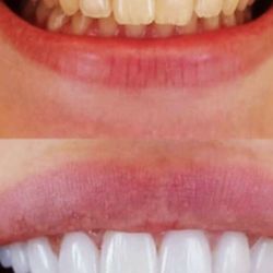 Sambath Keo, DMD - A before and after.
