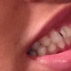 James Orrington II, DDS - Chatham Dental Care - Before my visit to Dr. Orrington's office.