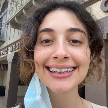 E-orthodontics - Right after braces got placed on! - Orthodontists Near Me - Tustin, California
