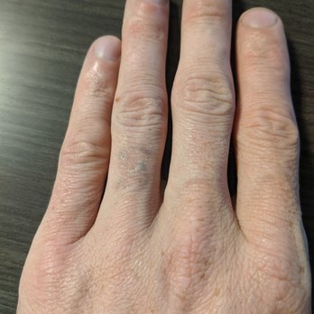 Kucumber Skin Lounge - 6 of the approximate 8 treatments in. - Skin Care Near Me - Seattle, Washington Kucumber Skin Lounge - 6 of the approximate 8 treatments in. - Skin Care Near Me - Seattle, Washington
