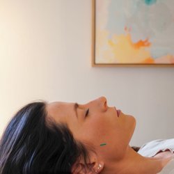 Balance Acupuncture - Acupuncture can work wonders to release jaw tension