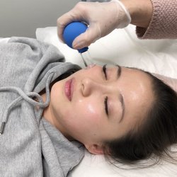Kien Toan Acupuncture and Herbs - Facial cupping with vitamin E oil to simulate collagen production
