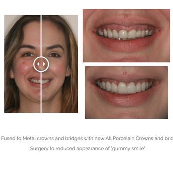Pasadena Dental Aesthetics - General Dentistry Near Me - Pasadena, California Pasadena Dental Aesthetics - General Dentistry Near Me - Pasadena, California