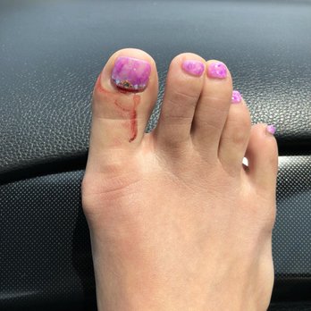 Coco Nails art - Bleeding - Nail Salons Near Me - New York, New York Coco Nails art - Bleeding - Nail Salons Near Me - New York, New York