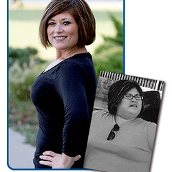 WeightWise Bariatric Program