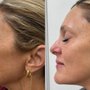 Get Glowing Medspa