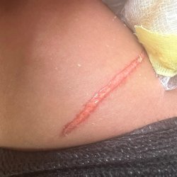 UCLA Health Marina del Rey Primary Care - Burn by kathryn goldrath