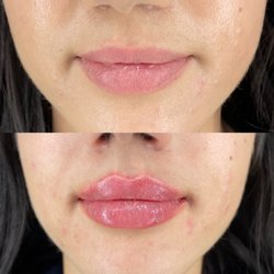 Bel Lavi Medical Aesthetics