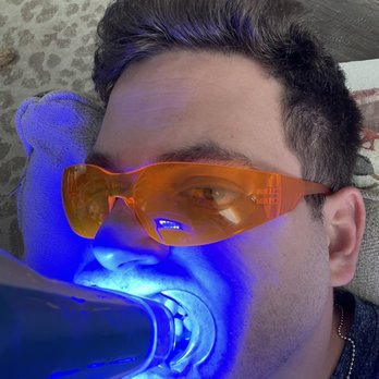 LIT Teeth Whitening - Teeth Whitening Near Me