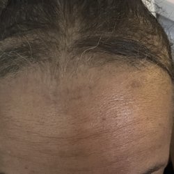 Gerow Hair Ink - Hair loss