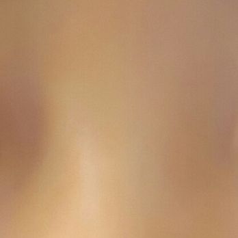 Aesthetic KS - 1 year post-op - Cosmetic Surgeons Near Me - Los Angeles, California Aesthetic KS - 1 year post-op - Cosmetic Surgeons Near Me - Los Angeles, California
