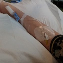 Attune Health - Attune Health painless iv