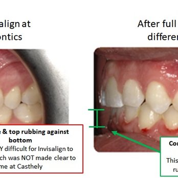 Casthely Orthodontics - Orthodontists Near Me - Miami, Florida Casthely Orthodontics - Orthodontists Near Me - Miami, Florida