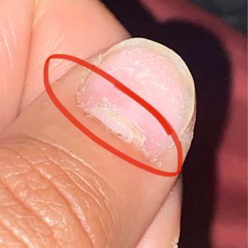 Legacy Nails Lounge - cut cuticle under acrylic nail - Nail Salons Near Me - Lynwood, California Legacy Nails Lounge - cut cuticle under acrylic nail - Nail Salons Near Me - Lynwood, California