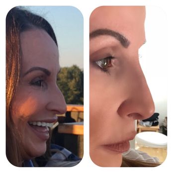 Juvly Aesthetics - Medical Spas Near Me - Fort Lauderdale, Florida Juvly Aesthetics - Medical Spas Near Me - Fort Lauderdale, Florida