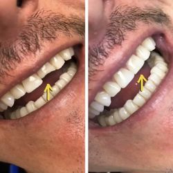 Dentists In Culver City Yelp