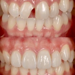 Advanced Dental Care