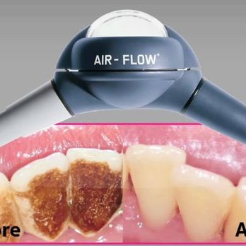 HappyDental - General Dentistry Near Me - Dublin, D