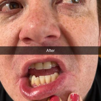 Dentique - We love his teeth now!! He can smile with confidence now! - Cosmetic Dentists Near Me - San Diego, California Dentique - We love his teeth now!! He can smile with confidence now! - Cosmetic Dentists Near Me - San Diego, California