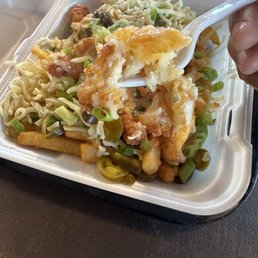 My bite