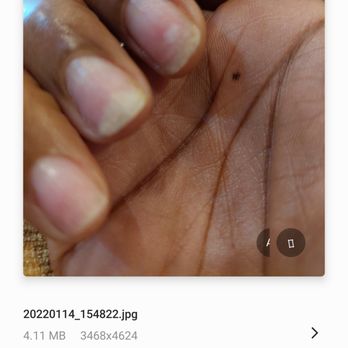 Grand Nail and Spa - Fungus on my nails on Jan 14 after removing dipped nails - Nail Salons Near Me - Aubrey, Texas Grand Nail and Spa - Fungus on my nails on Jan 14 after removing dipped nails - Nail Salons Near Me - Aubrey, Texas