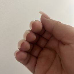 Thick nails Thick nails
