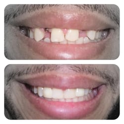 Harmony Dental Health - Dental Implant restorations done chairside in just 30 minutes!