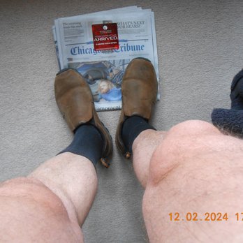 Marc A Asselmeier, MD - 2 years after unneeded surgery, knee swollen like a camels hump!!! thanks doc asselmeier!! - Surgeons Near Me - Glen Ellyn, Illinois Marc A Asselmeier, MD - 2 years after unneeded surgery, knee swollen like a camels hump!!! thanks doc asselmeier!! - Surgeons Near Me - Glen Ellyn, Illinois