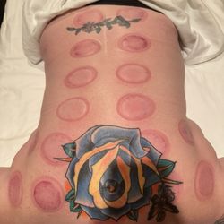 Classic Massage - Cupping, it is said to release toxins from your body. The marks stayed there for several days after, but so relaxing.