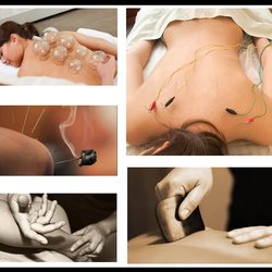 Lee's Acupuncture - Facial Rejuvination, Acupressure, Cupping, Moxa, Electrostimulation, and Herbal Medicine.