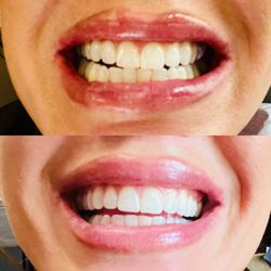 Infinity Dental Grandville