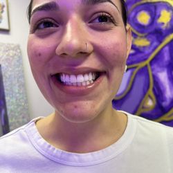 Keep It Bright Teeth Whitening Spa