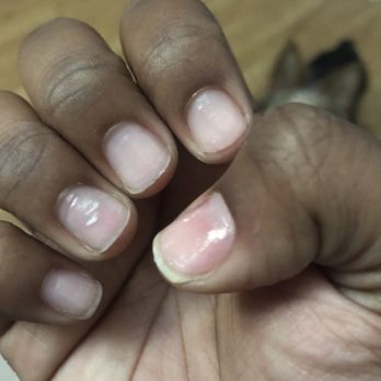 L A Nails - The aftermath. - Nail Salons Near Me - Bellflower, California