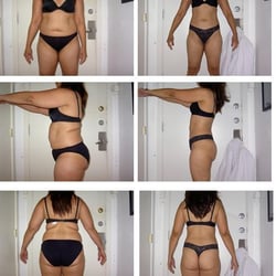 Before & After Wellness Center - Non-Invasive Express Weight Loss treatment (24 sessions) Exclusive at Before & After.Guaranteed Results