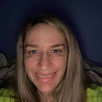 Suite Skin - Another photo of the under eyes looking quite insane 3 weeks after. - Medical Spas Near Me - Locust Valley, New York