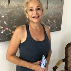 Sabastian Skin Care - An after shot of the dramatic difference with peel