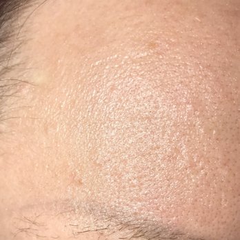 Lynn Duncan Permanent Cosmetics - Horrible eyebrow tattoo. Didn't even do it on my actual eyebrow! The pics say everything! - Cosmetic Surgeons Near Me - Delafield, Wisconsin